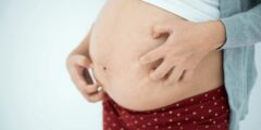 أسباب حكة البطن للحامل وهل تستدعي القلق؟